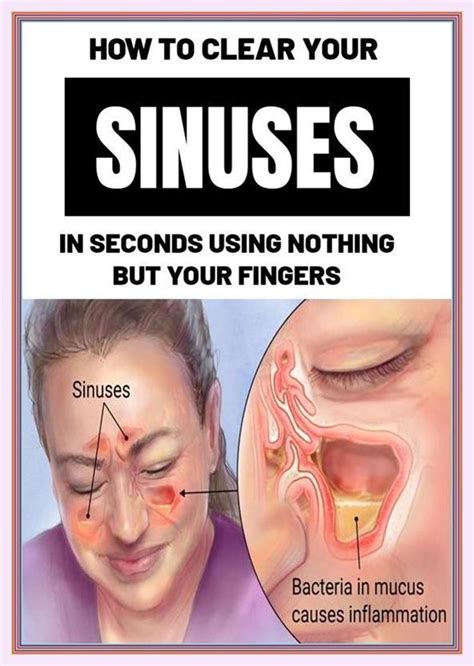 How To Clear Sinuses Fast