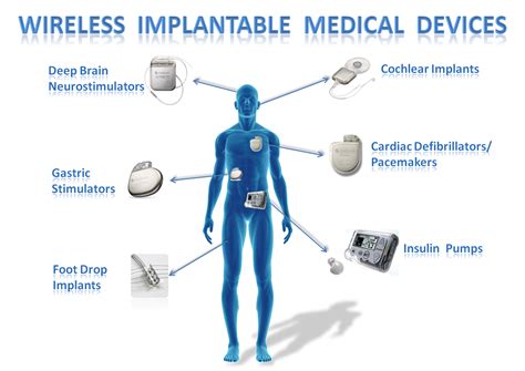 Ied Implanted Electronic Device In Medical Amp Science By