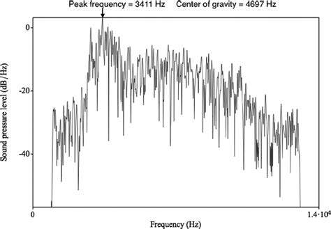 Spectrum For Spanish S In The Word Suspendidas Download Scientific Diagram