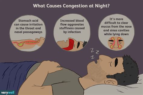 Why You Might Have A Stuffy Nose At Night